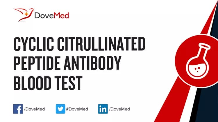 Cyclic Citrullinated Peptide Antibody Blood Test