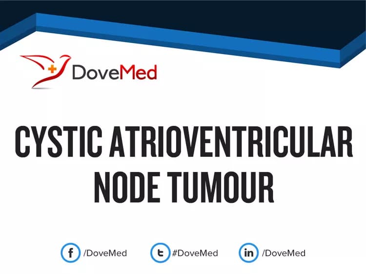 Cystic Atrioventricular Node Tumour