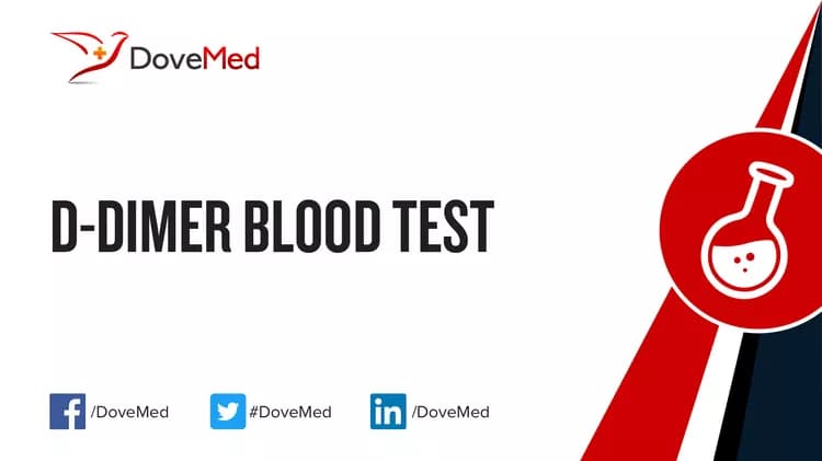 D-Dimer Blood Test