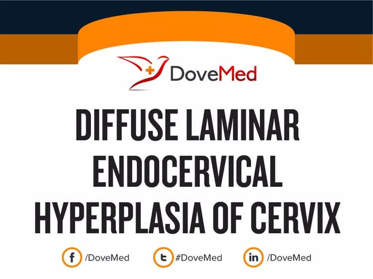 Diffuse Laminar Endocervical Hyperplasia of Uterine Cervix