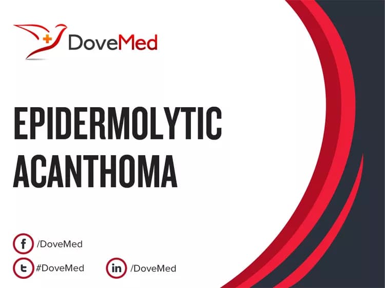 How well do you know Epidermolytic Acanthoma?