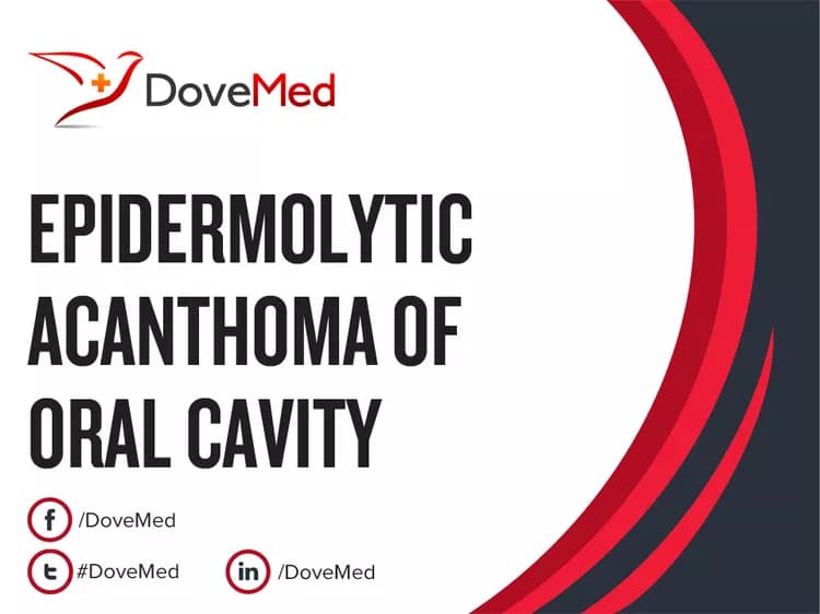 Epidermolytic Acanthoma of Oral Cavity
