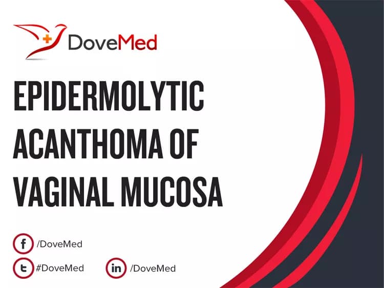 Epidermolytic Acanthoma of Vaginal Mucosa
