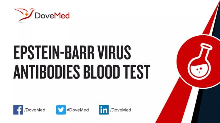 How well do you know Epstein-Barr Virus (EBV) Antibodies Blood Test?