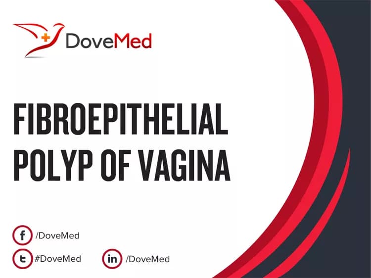 Fibroepithelial Polyp of Vagina