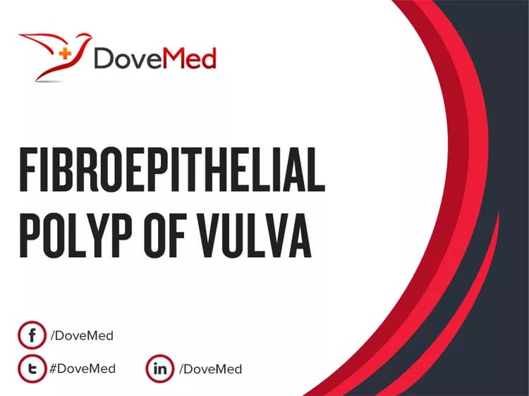 Fibroepithelial Polyp of Vulva