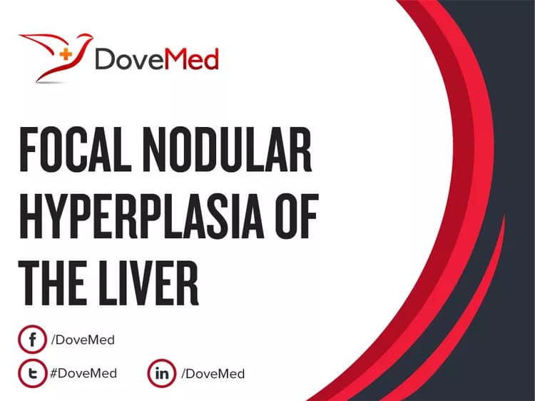 Focal Nodular Hyperplasia of the Liver