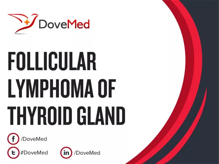 Follicular Lymphoma of Thyroid Gland