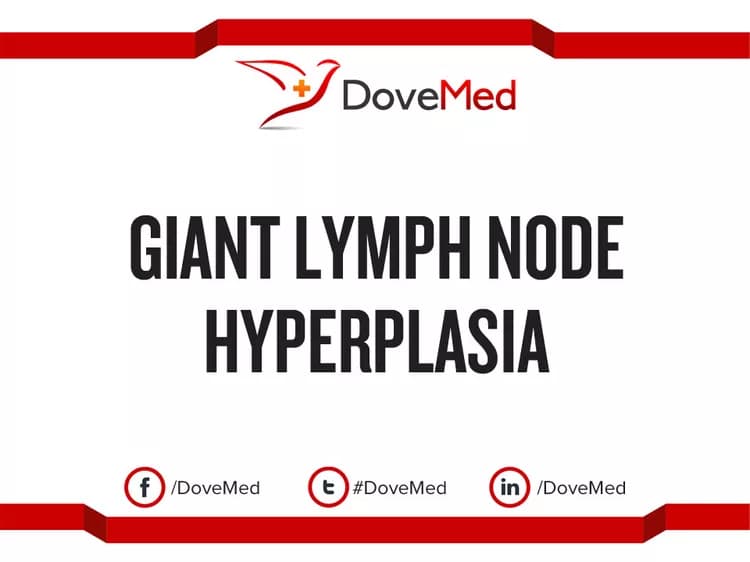 Giant Lymph Node Hyperplasia