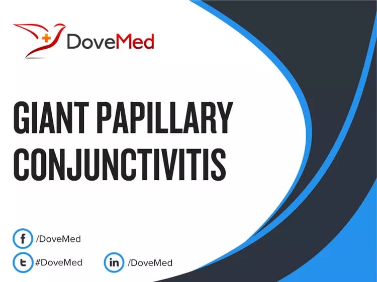 Giant Papillary Conjunctivitis (GPC)