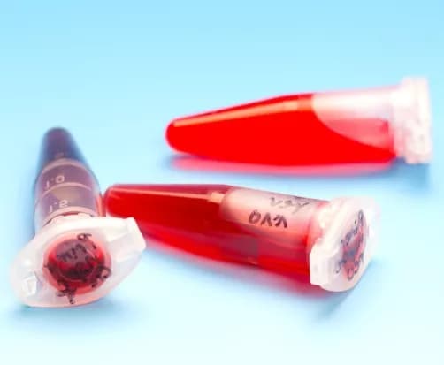 Erythropoietin Blood Test