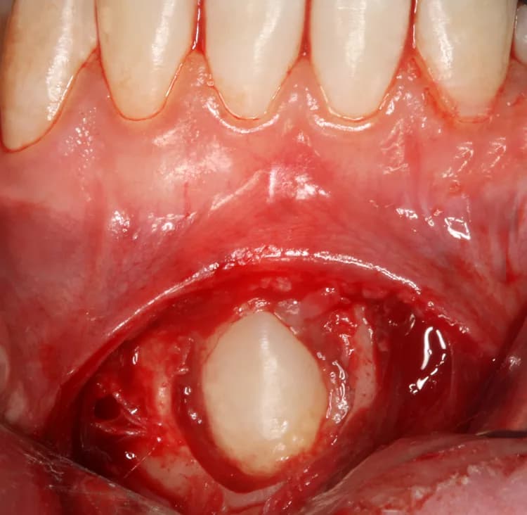 By Coronation Dental Specialty Group (Own work) [CC BY-SA 3.0 (http://creativecommons.org/licenses/by-sa/3.0)], via Wikimedia Commons