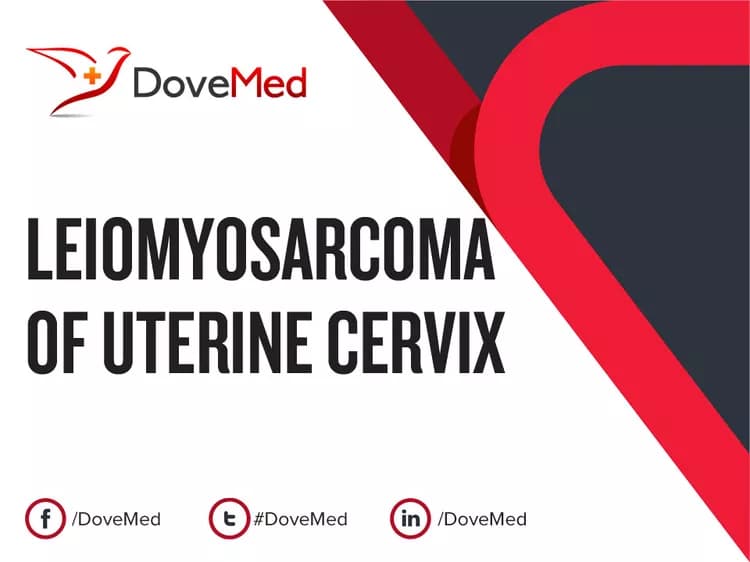 Leiomyosarcoma of Uterine Cervix