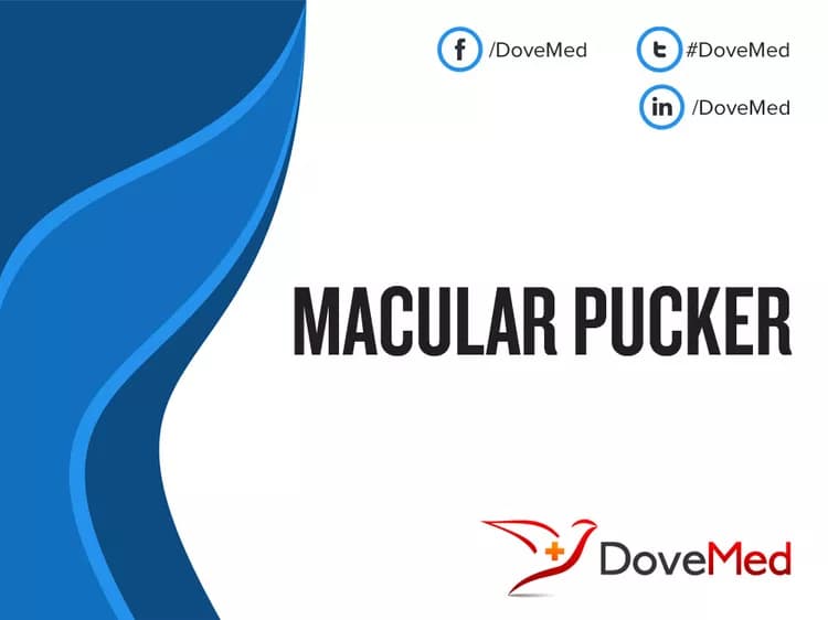 Macular Pucker