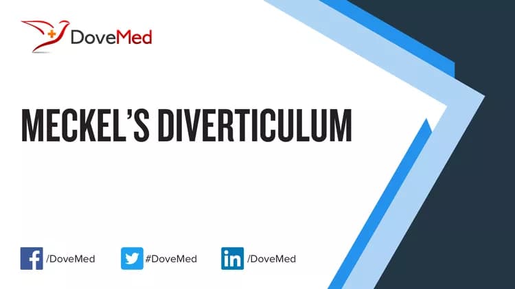 How well do you know Meckel’s Diverticulum