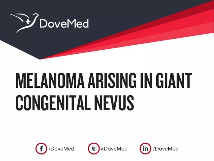 Melanoma arising in Giant Congenital Nevus