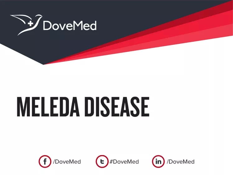 Meleda Disease