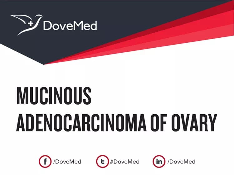 Mucinous Adenocarcinoma of Ovary