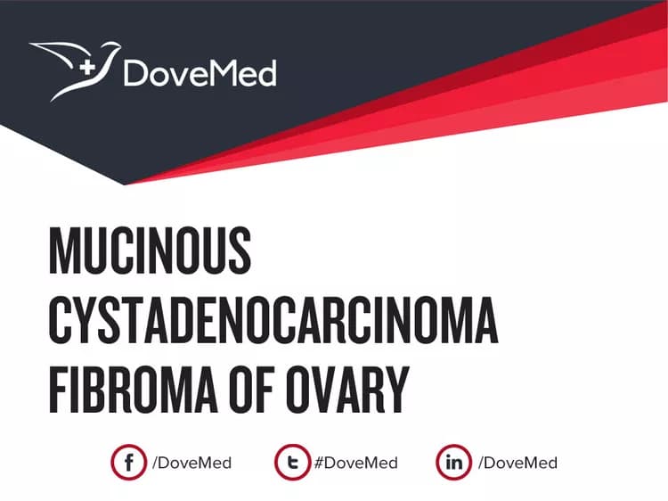 Mucinous Cystadenocarcinoma Fibroma of Ovary