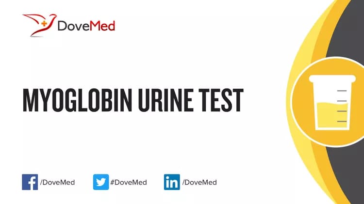 How well do you know Myoglobin Urine Test?