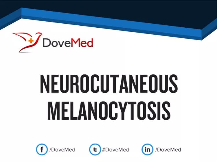 Neurocutaneous Melanocytosis