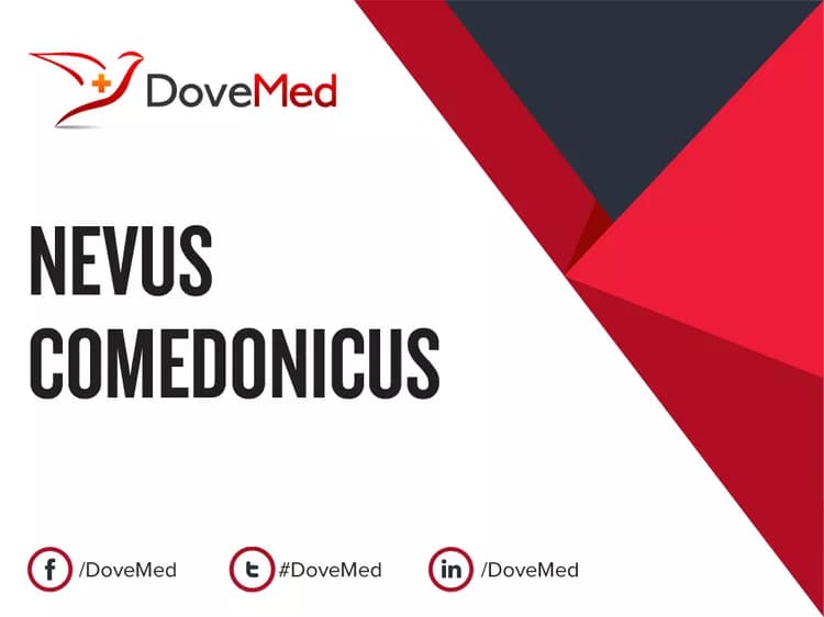 Nevus Comedonicus