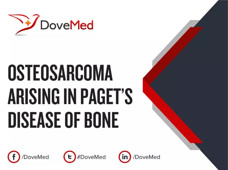 Osteosarcoma arising in Paget's Disease of Bone