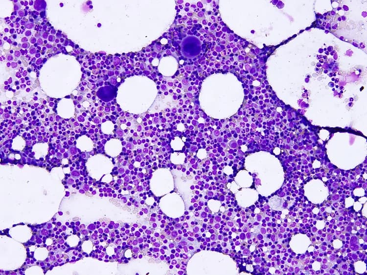 Fat Cells Originating From Bone Marrow Found In Humans