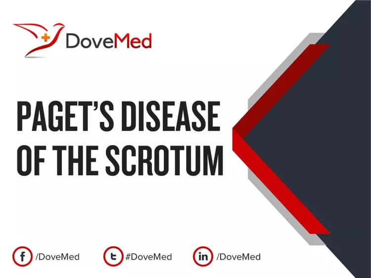 Paget’s Disease of the Scrotum