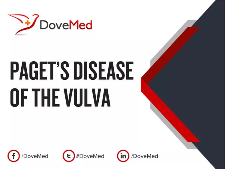 Paget’s Disease of the Vulva