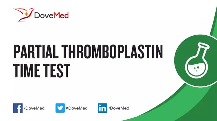 Partial Thromboplastin Time (PTT) Test