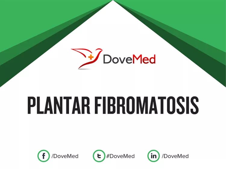 Plantar Fibromatosis