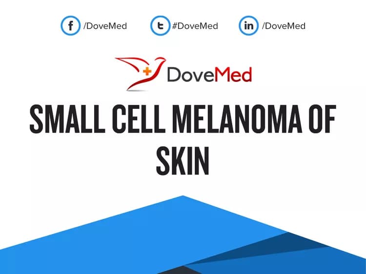 Small Cell Melanoma of Skin