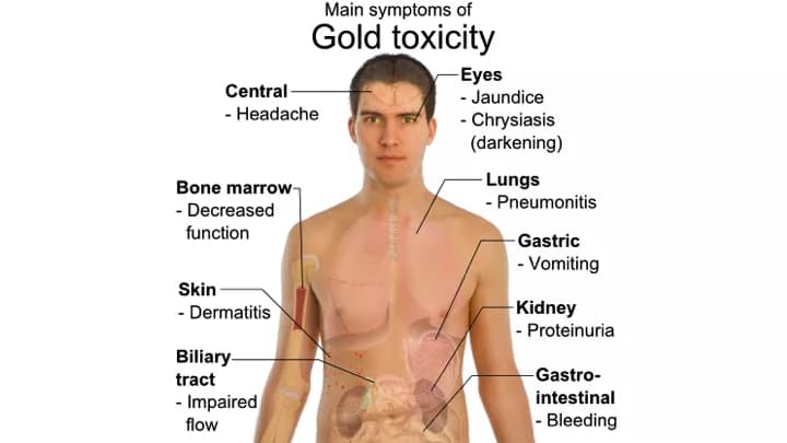 Gold Toxicity