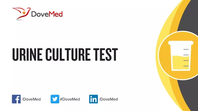How well do you know Urine Culture Test?