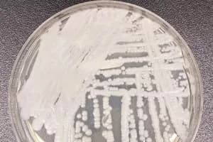 Candida Auris Infection