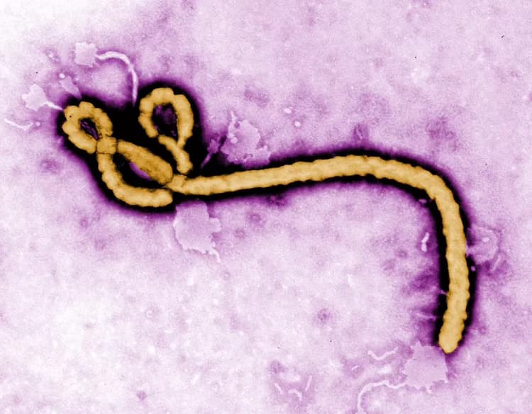 Breakthrough In Rapid, Mass Screening For The Ebola Virus