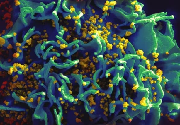 Frontline Attack Against HIV Infection Is Closer To Reality