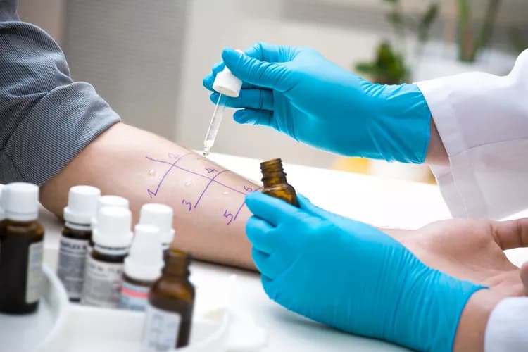 Allergy Blood Testing