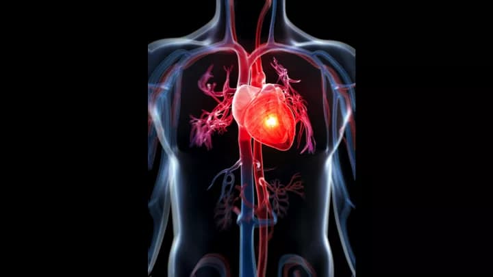 Men May Face High Lifetime Risk Of Sudden Cardiac Death