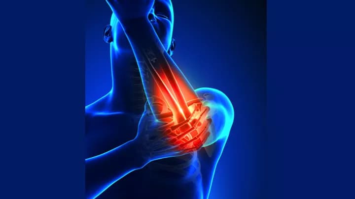 How well do you know Arthritis of the Elbow