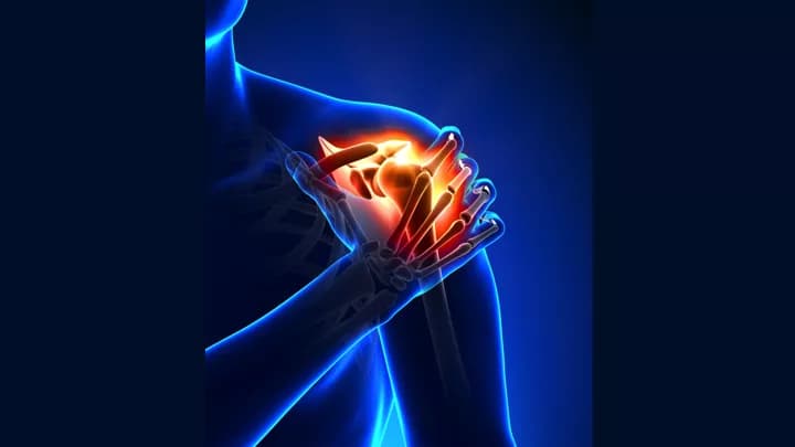 Facts about Rotator Cuff Tear (RCT)