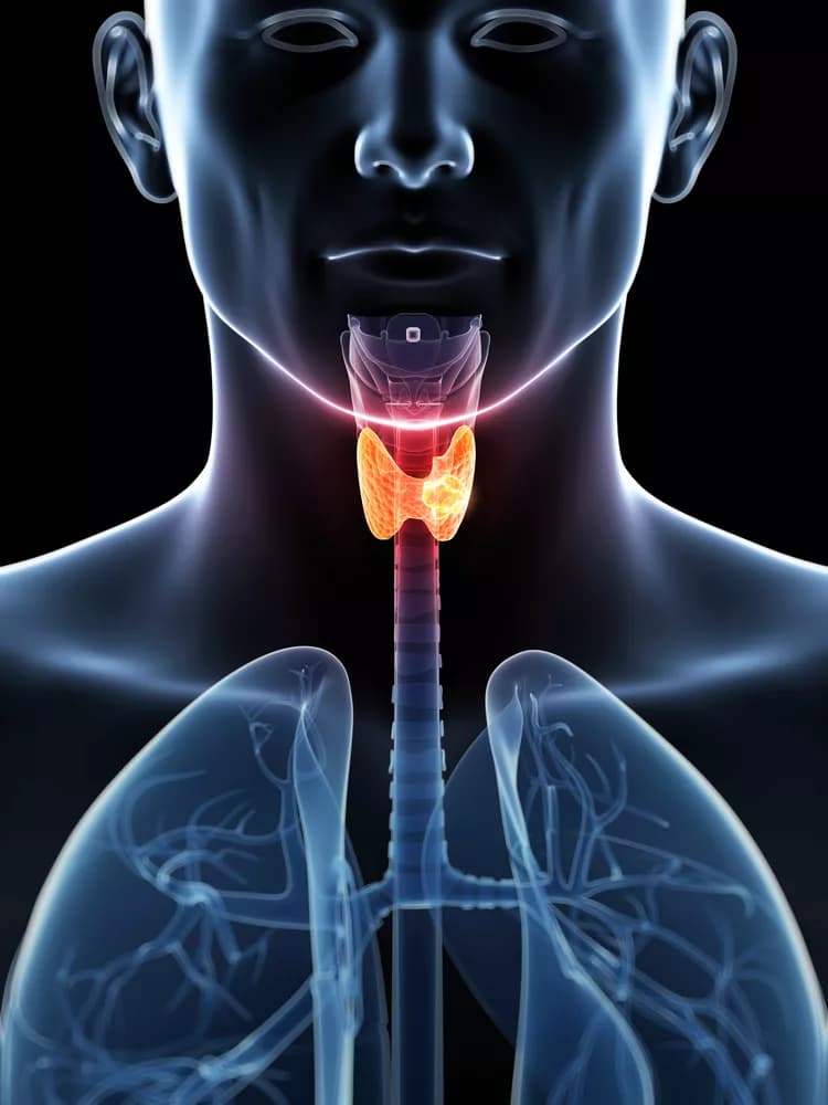 Facts about Anaplastic Thyroid Cancer