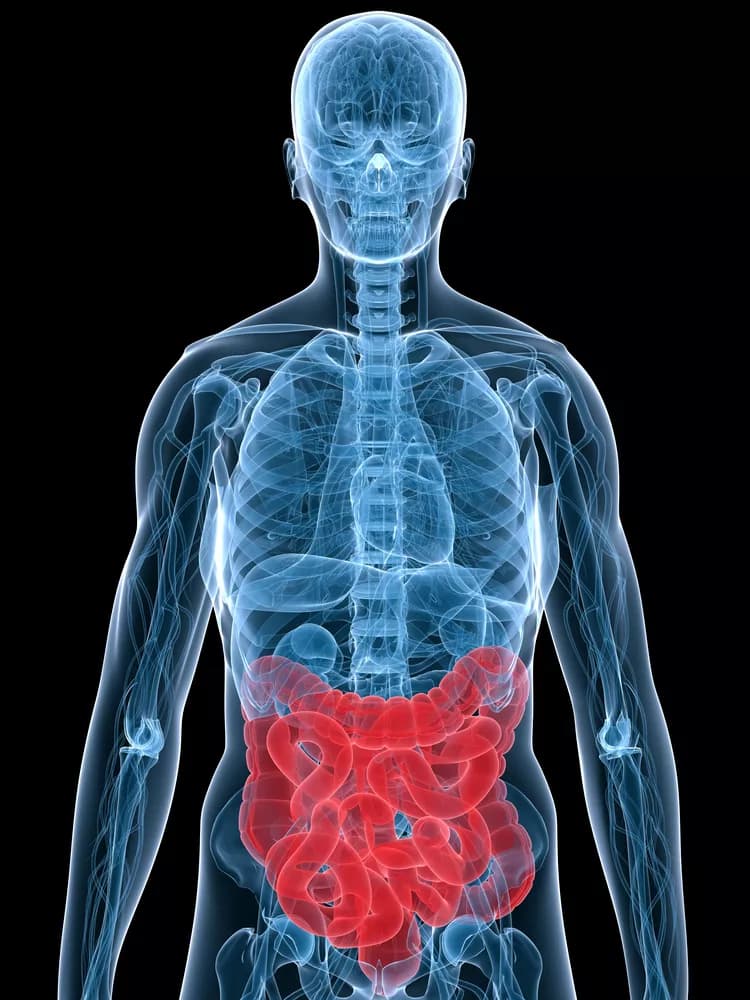 Diabetes Linked To Bacteria Invading The Colon