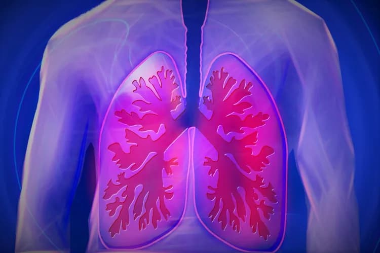 New Evidence About How To Prevent Worsening Pneumonia