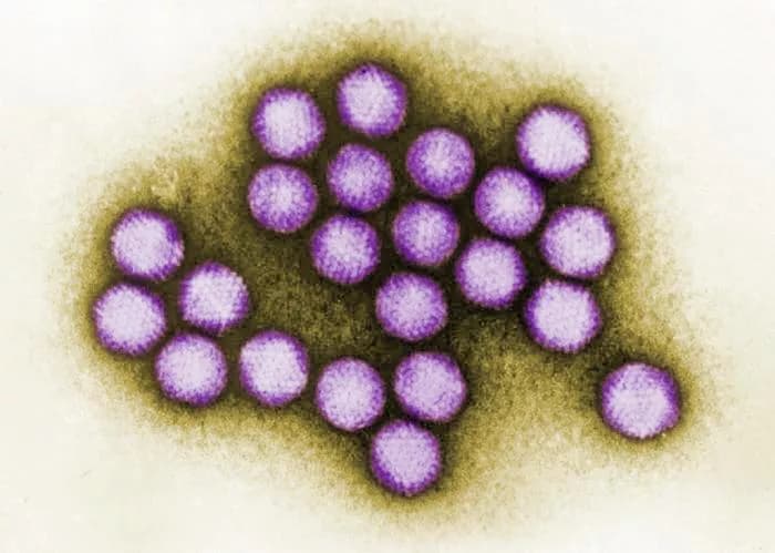 CDC