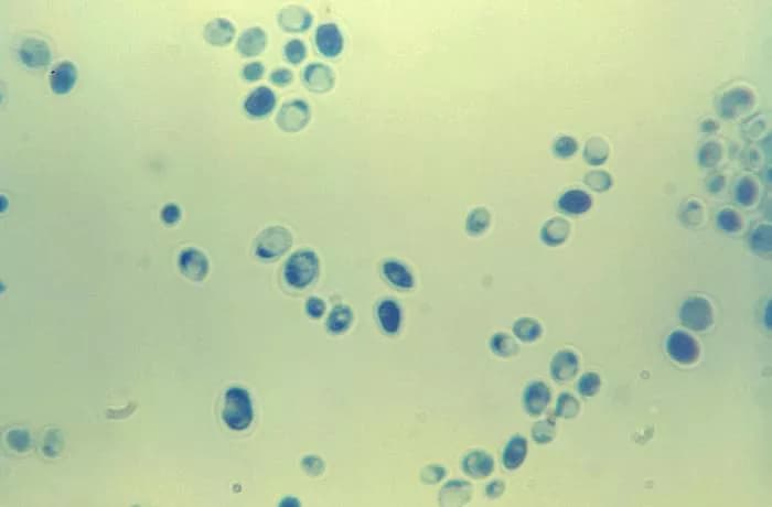 CDC/Dr. Lucille K. Georg