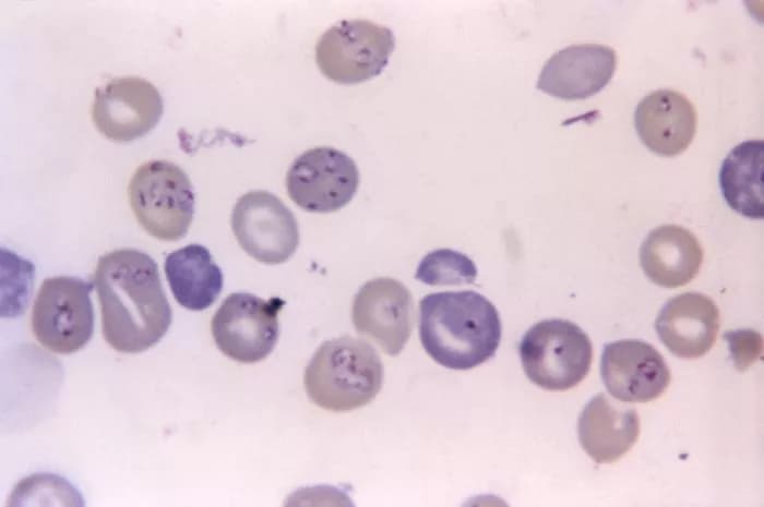 CDC/ Dr. George Healy