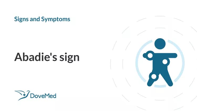 Abadie's sign