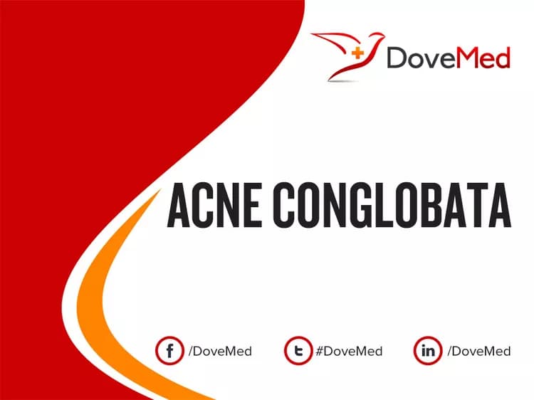 Acne Conglobata